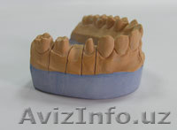 Продам Супер гипс для зубных техников и для стоматологов. - Изображение #1, Объявление #954287