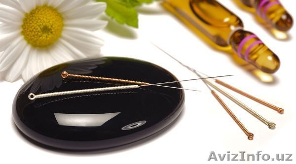 Иглорефлексотерапия, рефлексотерапия в Ташкенте - Изображение #1, Объявление #1578264