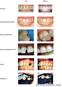 ООО "Darmon Dental" - Изображение #1, Объявление #1057505