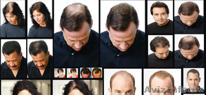 Выращивание волос — комплексная американская программа - Изображение #1, Объявление #1136073