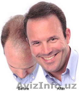 Загуститель волос Dermmatch - Изображение #1, Объявление #1279292