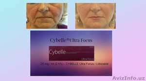 инъекционные препараты премиум класса  линии Cybelle  Brillas - Изображение #6, Объявление #1624151