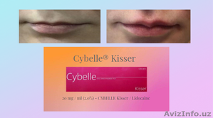 инъекционные препараты премиум класса  линии Cybelle  Brillas - Изображение #1, Объявление #1624151