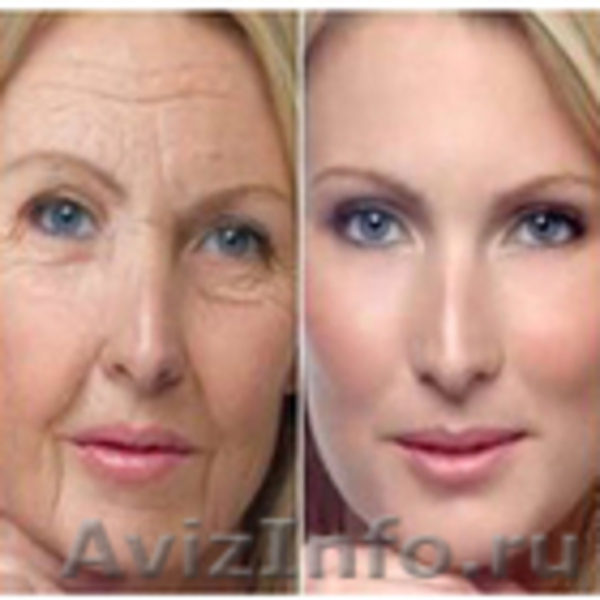 От морщин –эффективное средство !!! - Изображение #8, Объявление #1140378