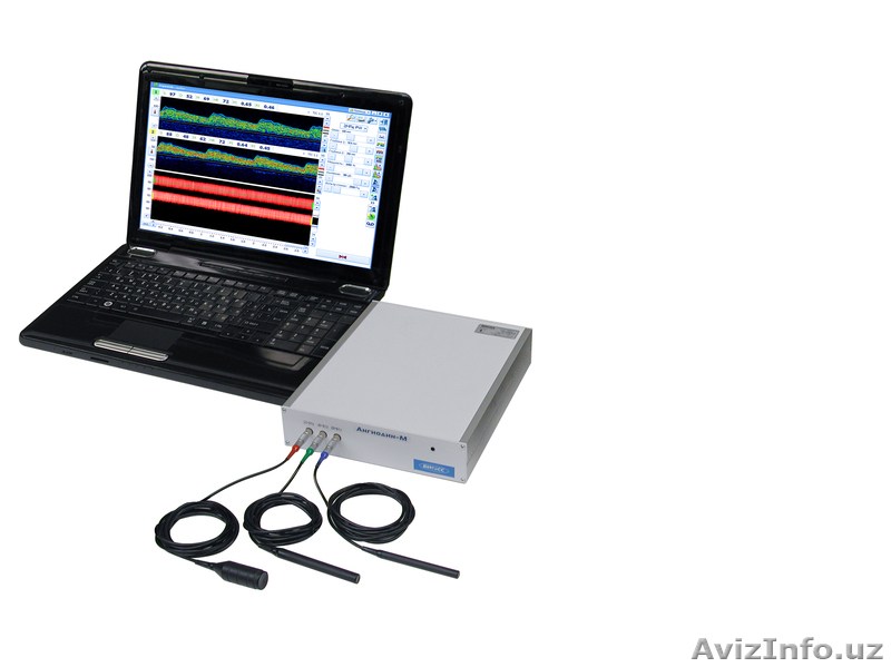 Миограф M-Test Ташкент - Изображение #6, Объявление #1048353
