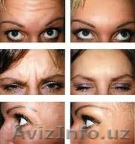 Ажинларига карши самарали янги махсулотни  кулланг ва ёшариб курининг!!! - Изображение #4, Объявление #1140380