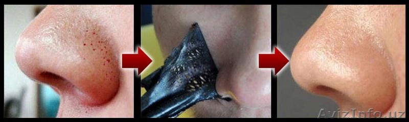 Black Mask от черных точек и прыщей купить в Ташкенте  - Изображение #3, Объявление #1555264