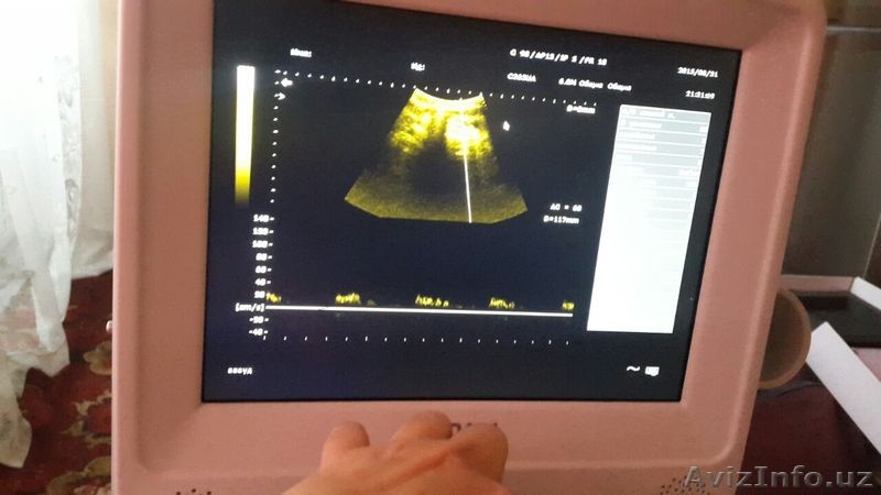 Ультразвуковой аппарат - Изображение #3, Объявление #1597752