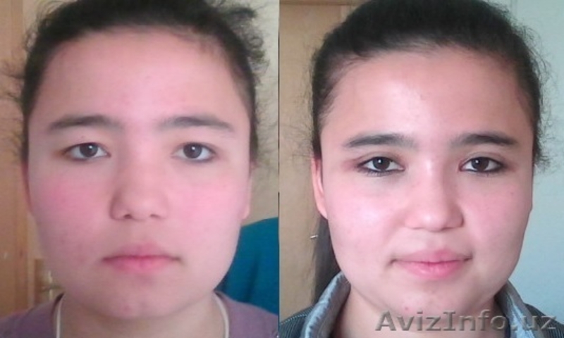 ПЛАСТИЧЕСКАЯ И ЭСТЕТИЧЕСКАЯ ХИРУРГИЯ - Изображение #4, Объявление #533305