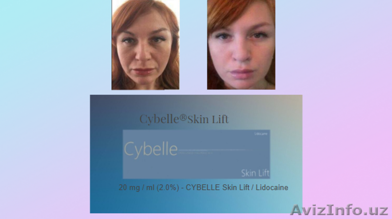 инъекционные препараты премиум класса  линии Cybelle  Brillas - Изображение #8, Объявление #1624151