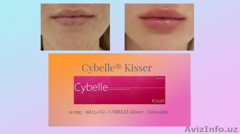 инъекционные препараты премиум класса  линии Cybelle  Brillas - Изображение #3, Объявление #1624151