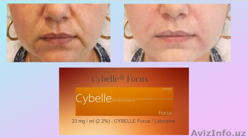 инъекционные препараты премиум класса  линии Cybelle  Brillas - Изображение #5, Объявление #1624151