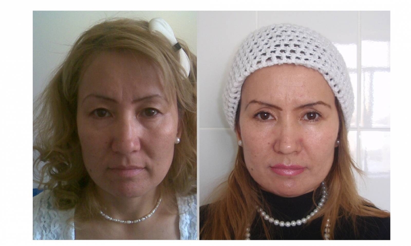 Пластические и косметические операции в клинике "Medicana" - Изображение #1, Объявление #1701146