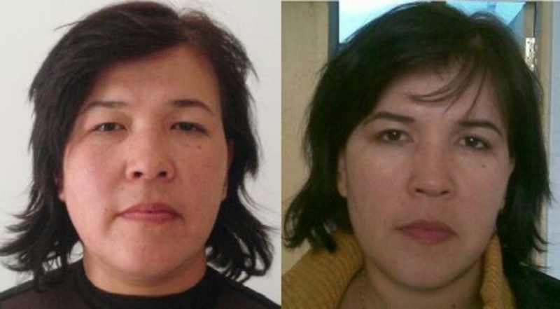 Пластические и косметические операции в клинике "Medicana" - Изображение #6, Объявление #1701146