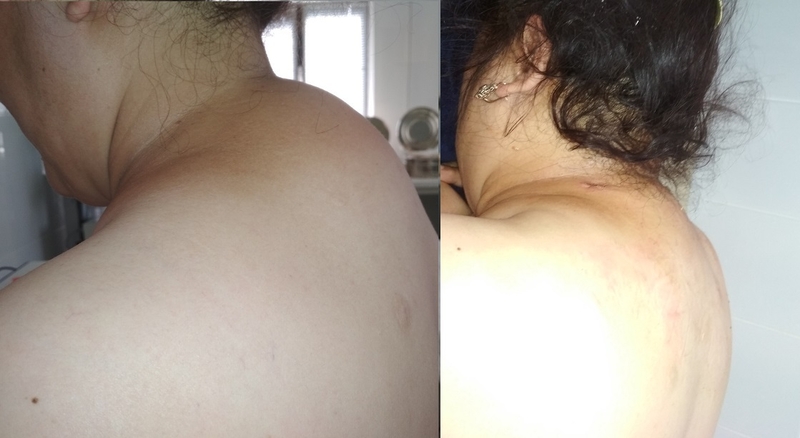 Пластические и косметические операции в клинике "Medicana" - Изображение #5, Объявление #1701146